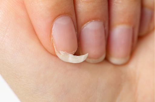 Die Auswirkungen der Ernaehrung auf die Nagelgesundheit 1