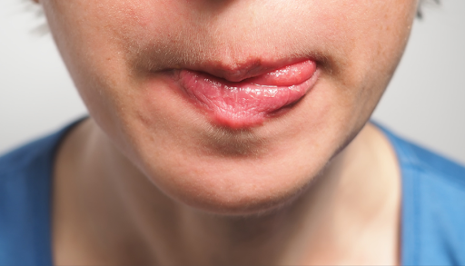 Welche Vitamine sollten bei trockenen Lippen ergaenzt werden 7